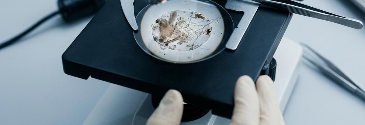 Primer plano de una preparación microscópica o muestra arqueológica con filamentos fúngicos visibles bajo luz de laboratorio